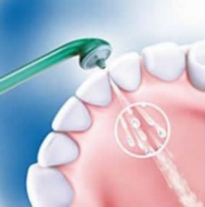 Esperar algo Perforar gritar Qué es un irrigador dental? | Irrigador Dental